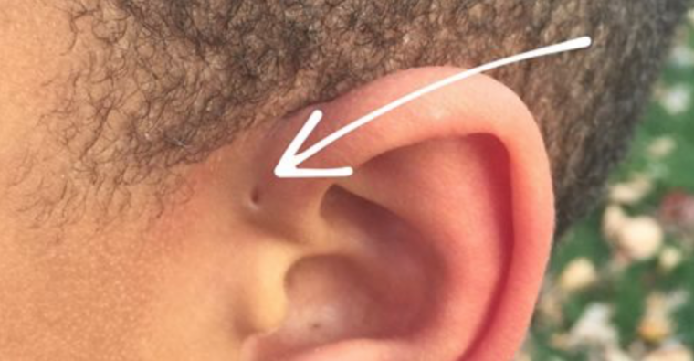 Sở hữu lỗ nhỏ ở vành tai là người có vận mệnh siêu phàm 