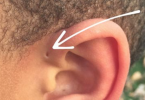 Sở hữu lỗ nhỏ ở vành tai là người có vận mệnh siêu phàm