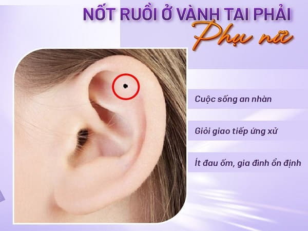 Ý nghĩa nốt ruồi ở vành tai phải phụ nữ