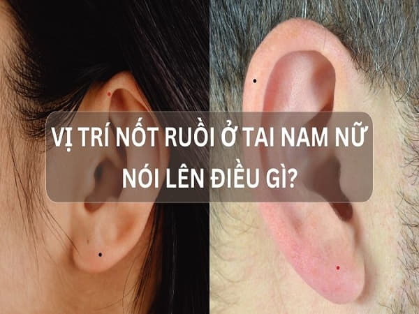 Ý nghĩa nốt ruồi ở dái tai nói chung